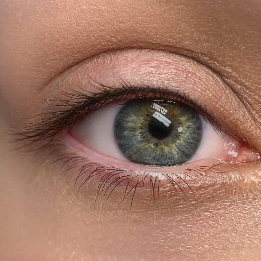Wimpernkranzverdichtung result at Bacani Atelier Vienna